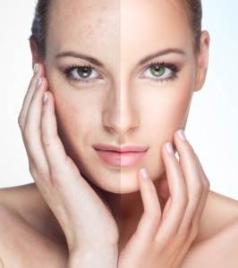 acne-doctor-miami-dermatologist-miami-dermatology