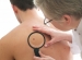 skin-cancer-treatment-in-miami