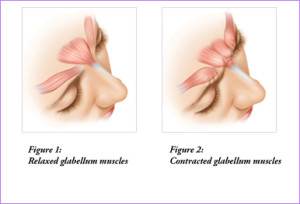 Diagram of skin aging