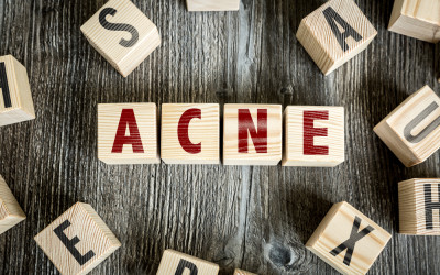 acne ad