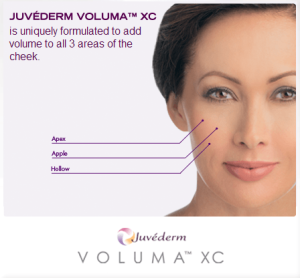 Announcement for launch of JUVÉDERM VOLUMA™ XC