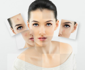 Acne Doctor Near South Miami Heights