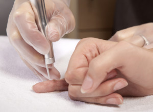 Wart Removal Near Doral