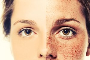 Skin-Cancer-Dermatology
