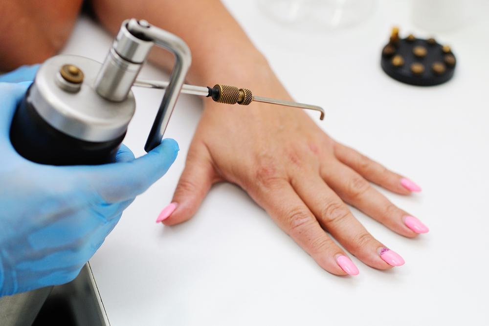 Woman with pink nails getting a wart treatment
