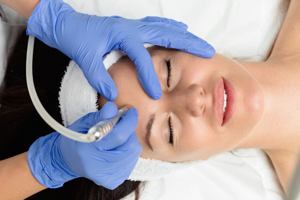 ​Microdermabrasion in South Miami