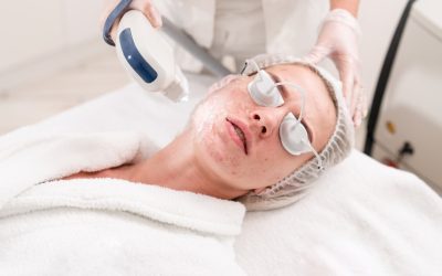 Woman with cystic acne receiving laser treatment.