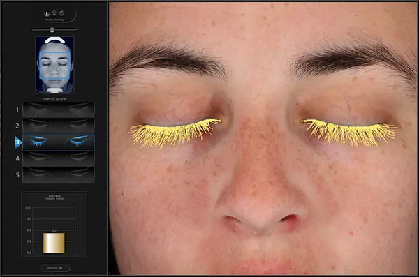 Advanced Eyelash Analysis Technology Eyelash analysis screen with highlighted lashes on a person's closed eyes.