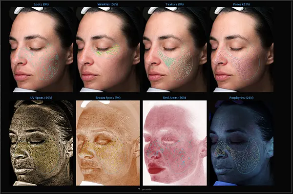 Comprehensive Facial Skin Analysis Display Facial skin analysis showing various conditions like pores, wrinkles, and spots in detailed images.