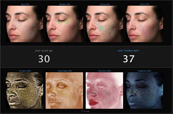 Dermatological Imaging Analysis of Skin Age and Features A woman's face shown in dermatological imaging highlighting spots, wrinkles, texture, and pores with age analysis.