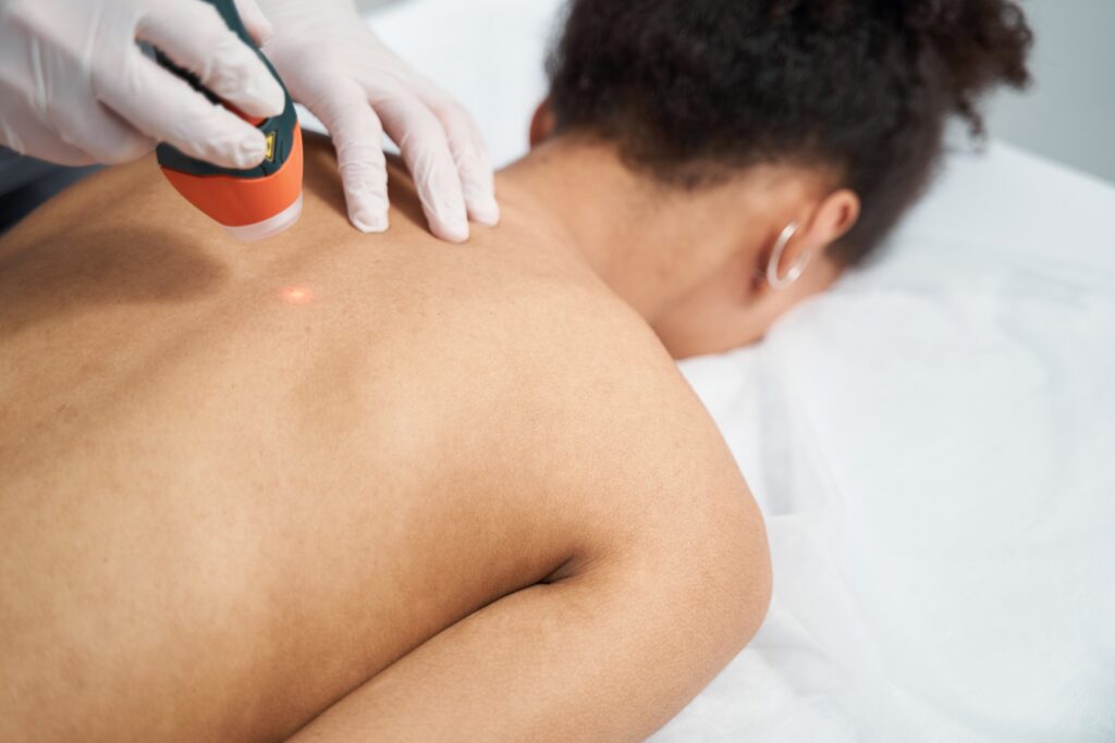 Laser therapy on woman’s upper back