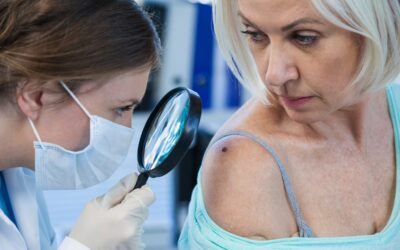 Dermatologist checking mole on woman’s shoulder