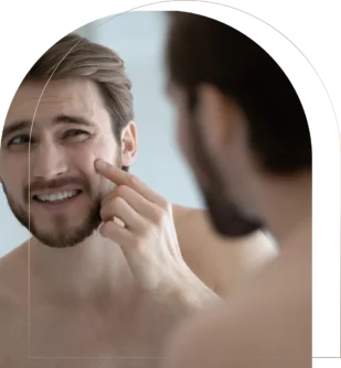 Young man examining acne on cheek in bathroom mirror Man checking acne on cheek in mirror