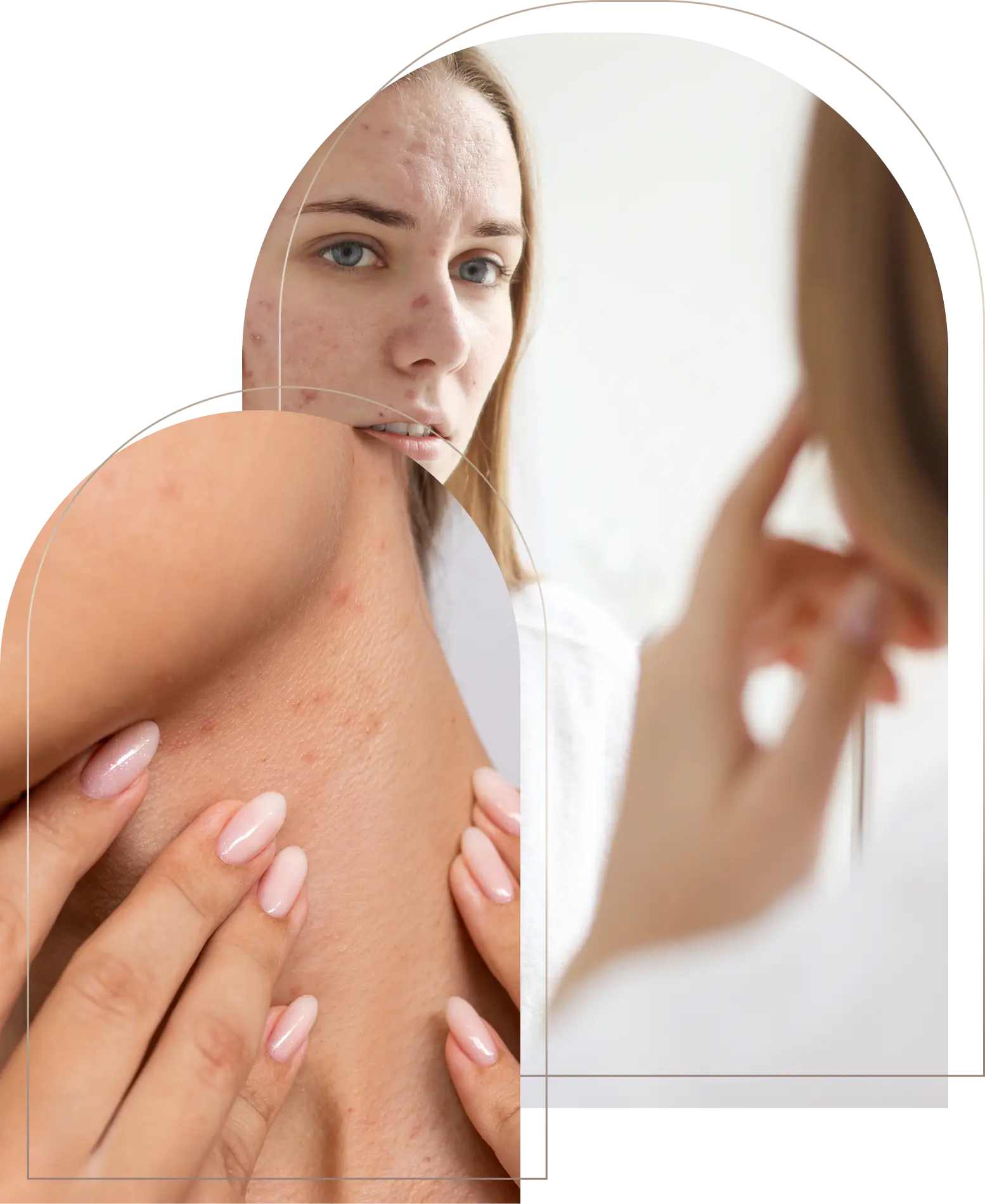 Woman examining acne on face and shoulder in mirror Woman checking acne on face and shoulder