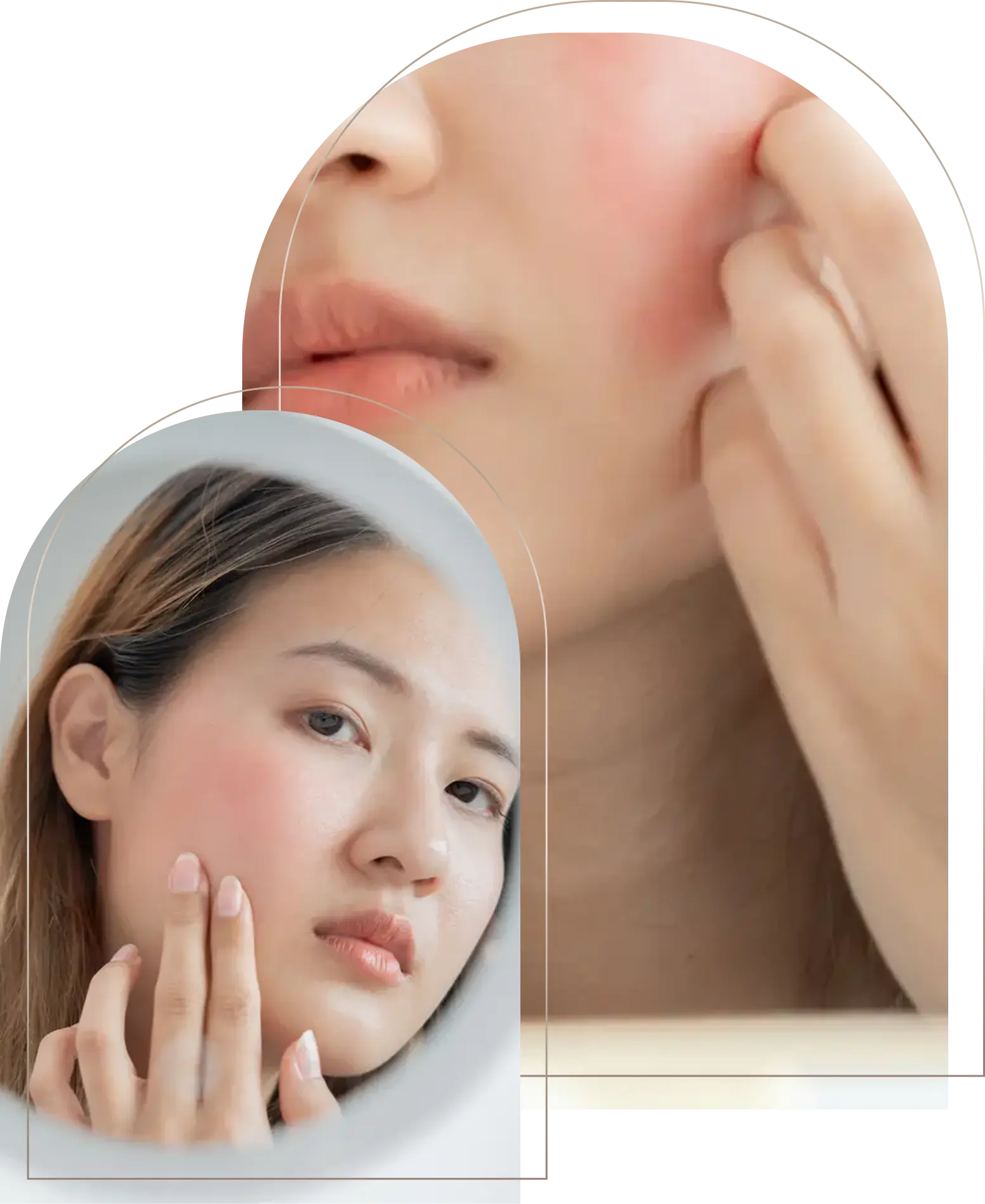 Woman examining red irritated skin on cheek in mirror Woman checking red irritated cheek skin